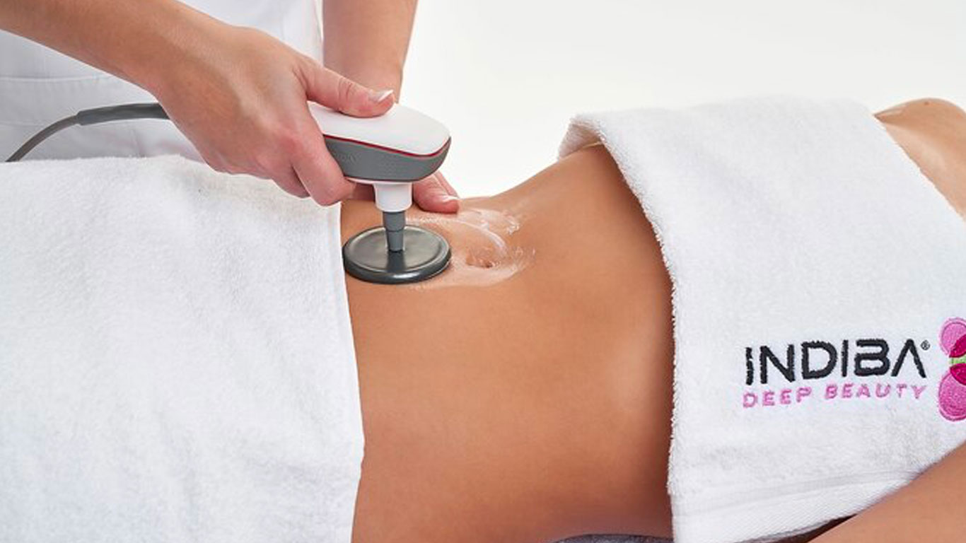 お腹インディバの効果